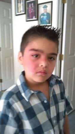 Kid with red face